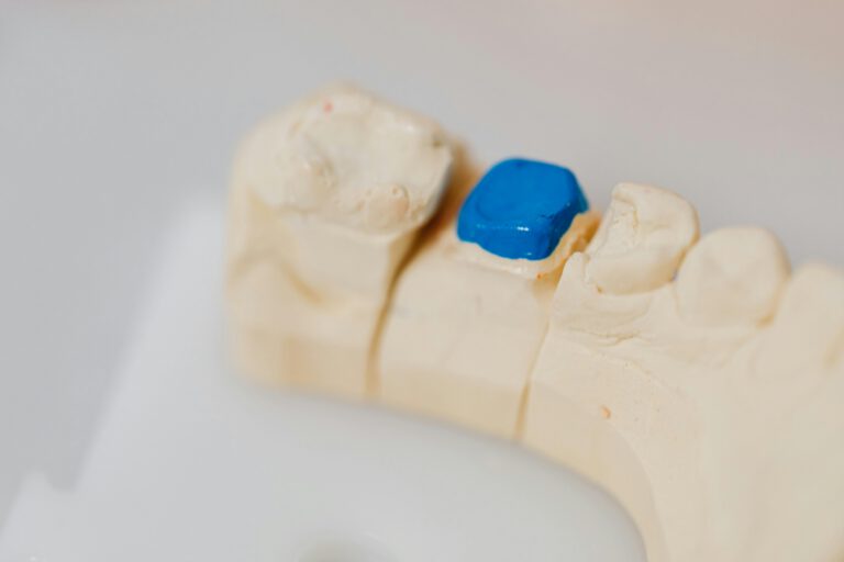 Close-up of a dental jaw model with a blue filling, showcasing dental anatomy and dentistry tools.
